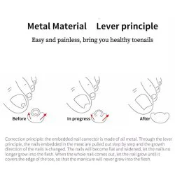 دستگاه اصلاح فرم و ارتودنسی ناخن مدل Nails